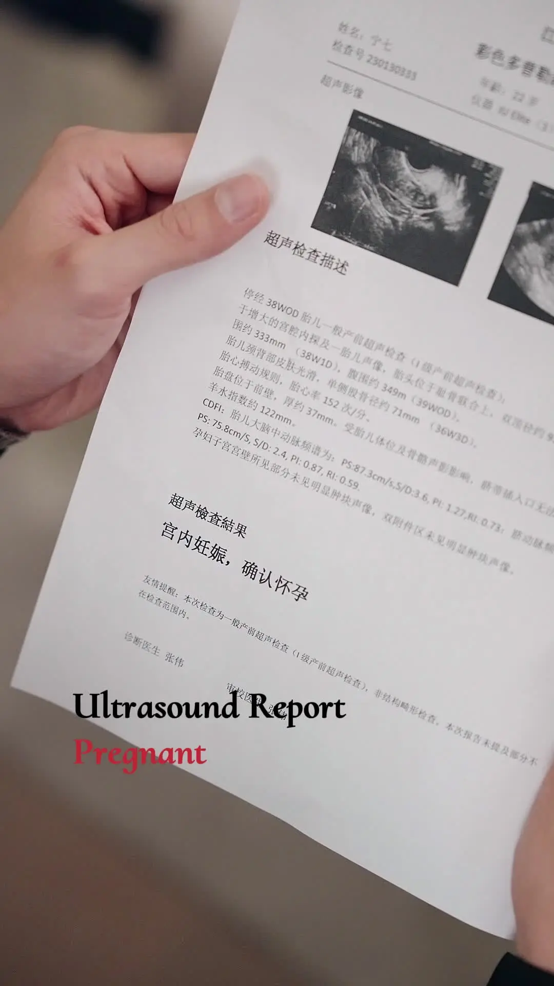 Episode 87 of From His Tutor to His Darling