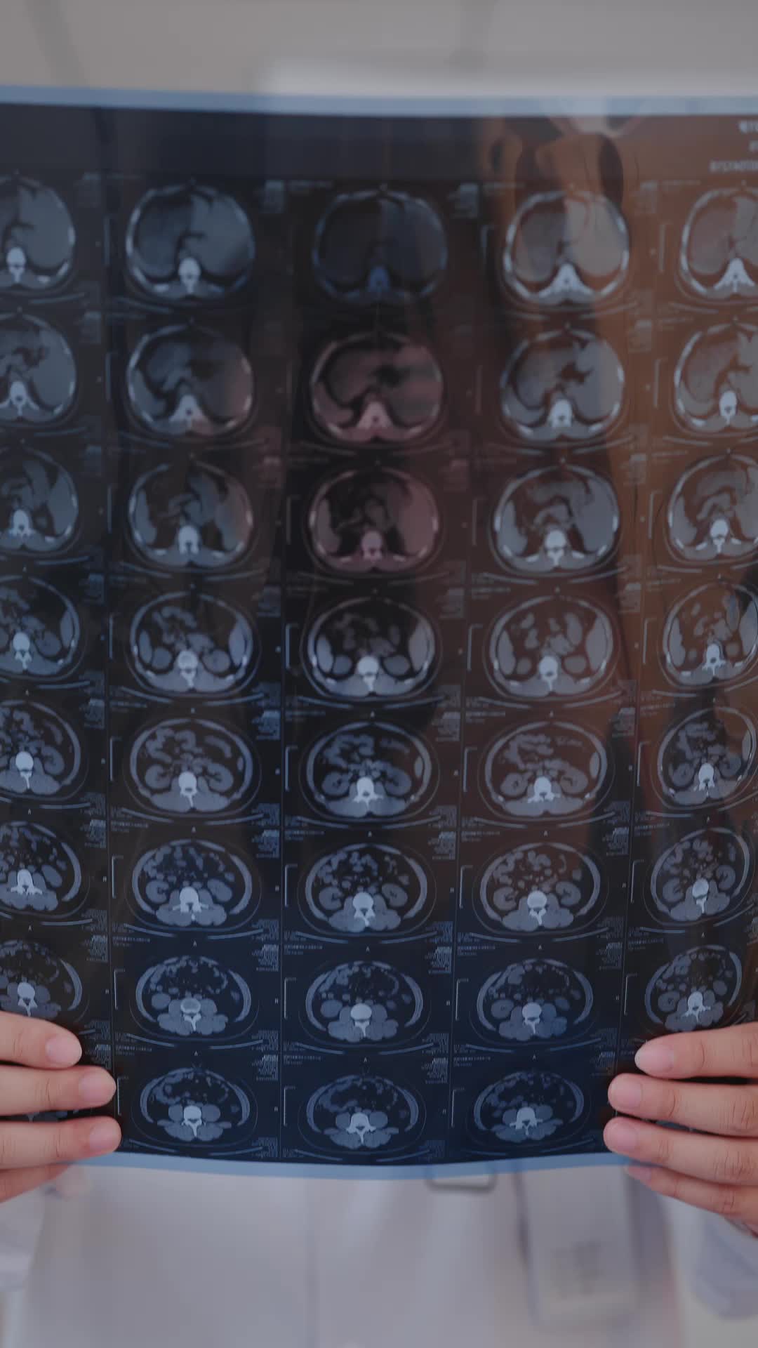 Episode 1 of Her Kidney, His Regret